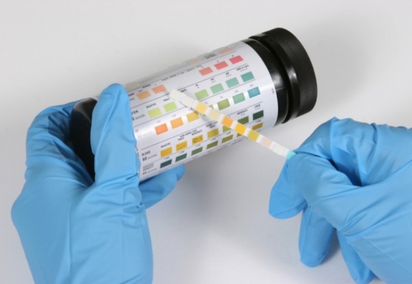 What Is Normal Urine Test